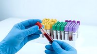 Medical laboratory technician in blue gloves holding blood sample test tube with colorful collection tubes in background for diagnostic testing.