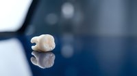 Single dental crown on reflective surface with blurred clinical background. Professional dentistry concept for oral health, restorative procedures and dental care.