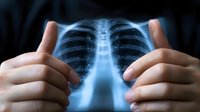 Medical professional holding chest x-ray film against light, examining ribcage and spine structure for diagnosis. Healthcare concept showing radiological examination.