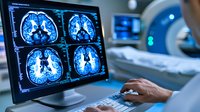 Medical professional analyzing brain MRI scan results on computer monitor in hospital setting with MRI machine visible in background. Healthcare diagnostic process.