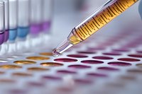 Laboratory pipette dropping yellow liquid sample into multiwell plate for medical testing and research analysis in modern clinical facility.