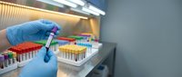 Laboratory technician in blue gloves handling test tube with colorful sample vials in medical research facility for scientific analysis and diagnostics.