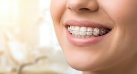Young woman with metal braces smiling showing orthodontic treatment for teeth straightening and dental care in modern clinic setting.
