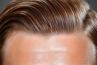 Close-up view of male forehead with styled brown hair combed back, showing hairline and skin texture detail against dark background. Professional grooming concept.