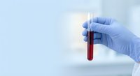 Medical professional in blue latex gloves holding blood sample test tube for laboratory analysis and diagnostic testing in clinical environment.