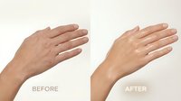 Hand rejuvenation comparison showing aging spots removal and skin smoothing treatment results for cosmetic dermatology and skincare advertising.