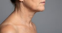 Mature woman profile showing neck and jawline aging signs, wrinkles and sagging skin for skincare, cosmetic surgery and anti-aging treatment concepts.