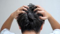 Person scratching scalp with both hands showing dandruff and dry itchy skin condition on white background, rear view of dark hair and head.