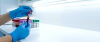 Laboratory technician in blue gloves handling blood sample tubes in medical testing facility for diagnostic analysis and healthcare research.