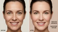 Middle-aged Caucasian woman showing anti-aging skincare treatment results with visible wrinkle reduction and smoother skin texture in before after comparison.