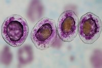 Microscopic view of human white blood cells stained with purple dye showing cellular structure and nucleus details in medical laboratory research.