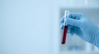 Medical professional in blue latex gloves holding blood sample test tube for laboratory analysis and diagnostic testing in clinical healthcare setting.