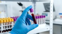 Laboratory technician in blue gloves holding blood sample tube for medical testing and analysis in clinical research facility.