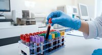 Laboratory technician in blue gloves handling colorful blood test tubes in medical research facility for diagnostic analysis and healthcare testing.
