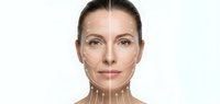 Middle-aged Caucasian woman face with cosmetic surgery marking lines for facelift procedure on white background isolated for medical beauty design.