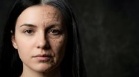 Young woman face showing aging process with wrinkles and smooth skin comparison for skincare and anti-aging treatment concepts on dark background.