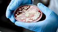 Bacterial colonies growing on red agar plate in petri dish held by scientist wearing blue latex gloves, close up view of microbiological research.
