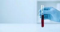 Medical professional in blue latex gloves holding blood sample test tube in laboratory for clinical analysis and diagnostic testing procedures.