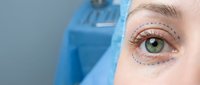 Close-up of Caucasian woman's green eye with surgical markings for cosmetic eyelid surgery preparation. Medical professional in blue scrubs background.