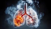 Anatomical visualization of human lungs with dramatic fire and smoke effect showing damage from smoking, medical concept against dark background.