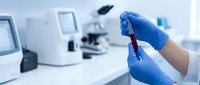 Medical laboratory technician in blue gloves holding blood sample test tube for analysis in modern clinical research facility with microscope equipment.