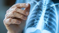 Medical professional examining chest x-ray film showing ribcage and spine, close-up view of doctor's hand pointing at diagnostic radiograph on light box.