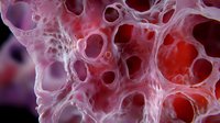Microscopic view of bone tissue structure showing porous trabecular architecture in red and pink tones, highlighting cellular networks and organic matrix patterns.