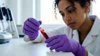 Young woman with curly dark hair and freckles, wearing white lab coat and purple latex gloves, examining blood sample in test tube during laboratory analysis and medical research.