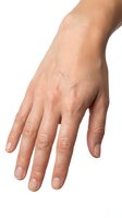 Human hand with natural skin texture isolated on white background showing palm and fingers for medical or skincare concepts.