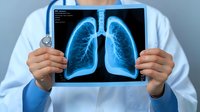 Medical professional in white coat holding up illuminated chest x-ray showing detailed lung scan with clear bronchial structure against blue background for healthcare presentation.