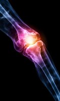 Glowing knee joint x-ray visualization showing inflammation and pain point in blue and red colors on black background for medical and healthcare concepts.