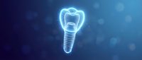 Glowing dental implant with crown on blue background. Modern dentistry concept for oral health, tooth replacement and medical technology presentations.