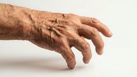 Senior male hand with age spots and wrinkles on white background, isolated for medical, healthcare, dermatology, aging, and educational design use.