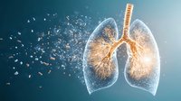 Glowing human lungs dissolving into particles against blue background, bronchial tree structure visible with anatomical detail, medical concept visualization.