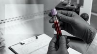 Medical laboratory technician in protective gloves holding blood sample test tube for analysis in clinical research facility with scientific equipment.