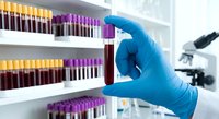 Medical laboratory technician in blue gloves holding blood sample tube for testing and analysis in clinical research facility with microscope equipment.