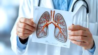 Medical professional holding anatomical diagram showing detailed bronchial tree and lung structure. Healthcare education and pulmonary system visualization for medical presentations.