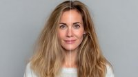 Before and after comparison of woman with long blonde hair showing skin transformation, beauty treatment results against neutral gray background.
