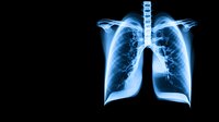 X-ray scan showing detailed view of human lungs and bronchi with bright blue glow effect against black background, medical visualization for healthcare and anatomy study.