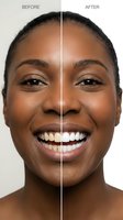 Before and after teeth whitening comparison of a smiling young Black woman, showing stained versus bright white teeth for dental care ads.