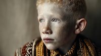Young albino boy with pale skin and light hair wearing traditional patterned clothing in warm indoor lighting for diversity and inclusion concepts.