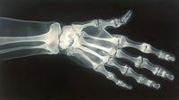 X-ray scan of human hand showing detailed bone structure with fingers, thumb, wrist joints and metacarpals on dark background for medical education.