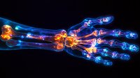 Glowing x-ray visualization of human hand bones showing joint inflammation and pain points in orange and blue colors on black background.