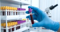 Medical laboratory technician in blue gloves holding blood sample test tube for analysis with microscope and specimen rack in clinical research facility.