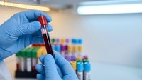 Medical laboratory technician in blue gloves holding blood sample test tube for analysis in clinical research facility with colorful specimens in background.