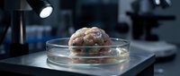 Human brain specimen in glass petri dish under laboratory lighting for medical research and neuroscience education purposes.