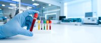 Medical professional in blue gloves holding blood sample tube in modern laboratory with colorful test tubes for clinical analysis and diagnostic testing.
