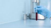 Medical professional in blue gloves holding blood sample test tube in modern laboratory for clinical analysis and diagnostic testing.