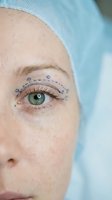 Close-up of woman's eye with blue surgical markings for cosmetic eyelid surgery procedure. Medical consultation and plastic surgery planning concept.
