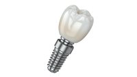 Dental implant with crown isolated on white background for medical and healthcare design projects.